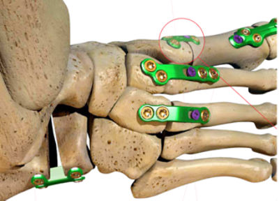 Ortholoc 3Di product image