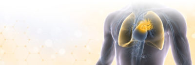 PE Hero Image