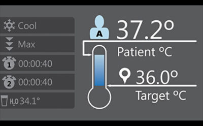 Simulazione della schermata di Altrix di Stryker che mostra la temperatura corrente del paziente rispetto alla temperatura target