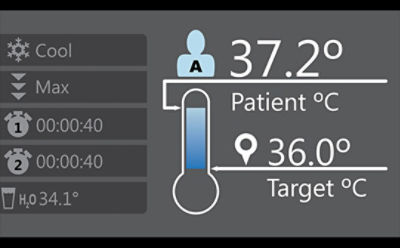 Simulation of Stryker's Altrix screen showing patient's current temperature compared to target temperature