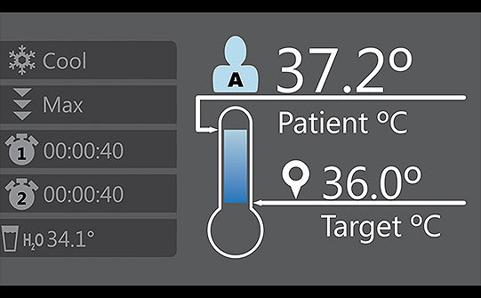 Symulacja ekranu systemu Altrix firmy Stryker, na którym widoczna jest bieżąca temperatura pacjenta w porównaniu do temperatury docelowej