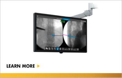 SpineMap Go - Augmented Fluoroscopy