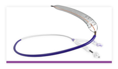 Clottriever Thrombectomy System