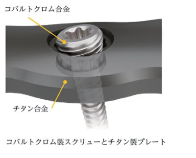 PangeaProductFeature_Material