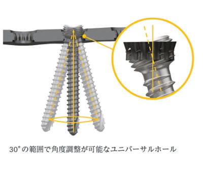 PangeaProductFeature_VariableAngle