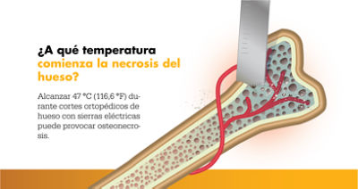 Sierra oscilante (para la cirugía de las articulaciones)