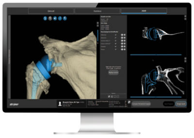 Planning Screen Mako Shoulder