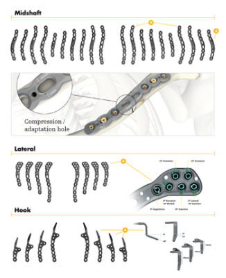 Superior Plating Options