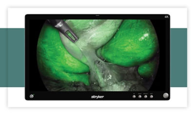 Surgical Displays