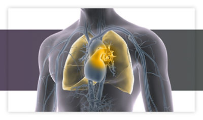 Pulmonary embolism