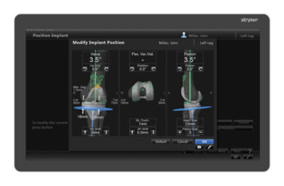 Ortho Guidance precision knee software