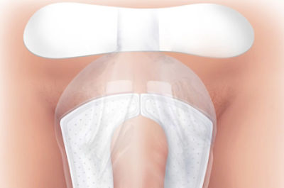 An illustration of the PrimoFit Flow staying in place on male anatomy