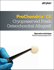 ProChondrix CR Operative Technique