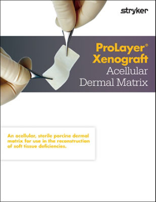 ProLayer Xenograft Sell Sheet