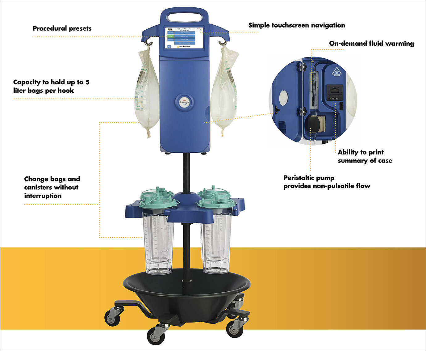 Thermedx FluidSmart - Features - Procedural presets | Simple touchscreen navigation | Capacity to hold up to 5 liter bags per hook | Change bags and canisters without interruption | On demand fluid warming | Ability to print sumary of case | Peristaltic pump provides non pulsatile flow