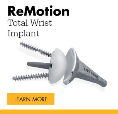 ReMotion