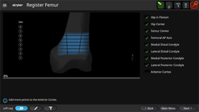 Mako RPS register anatomy software screen