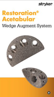 Restoration Acetabular Wedge Augment System design rationale