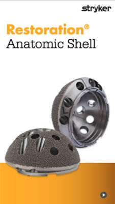 Restoration Anatomic Shell design rationale