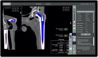 Restoration modular femoral hip stem planning
