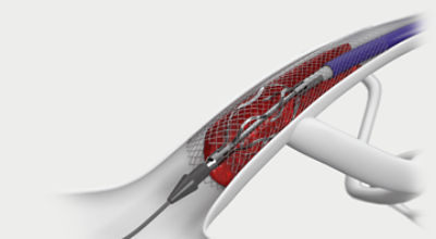 RevCore anatomy