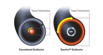 Stryker Synchro2 -torque transmission