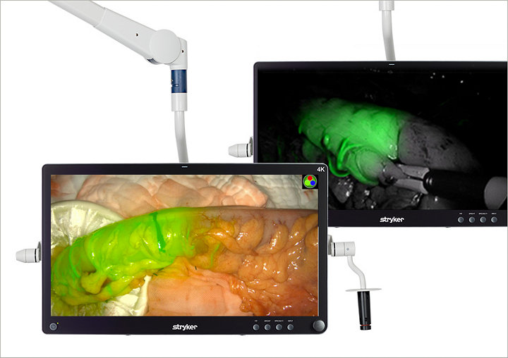 1588 AIM + SPY Fluorescence Technology - Colorectal Surgery