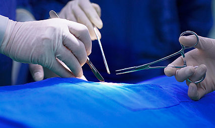 Preoperative strategy to reduce the risk of surgical site infection