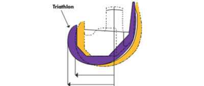 Reduced femoral offsetting
