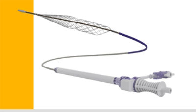 Small Venous Thrombectomy