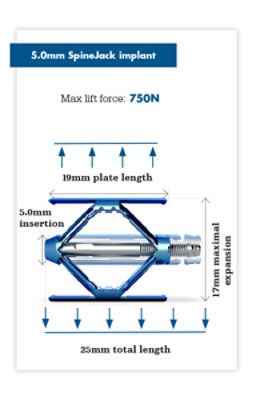 Product specs for 5.0mm SpineJack implant
