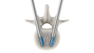 SpineJack_VCF-campaign_1200x680