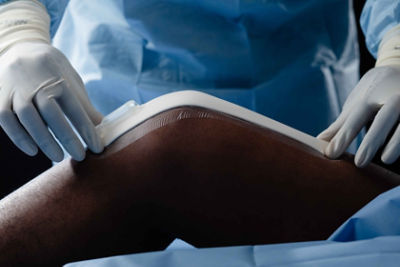 Stryker NPSeal Photos - 1T2A8275