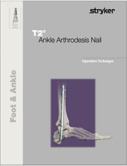 T2 Ankle Arthrodesis Nail operative technique