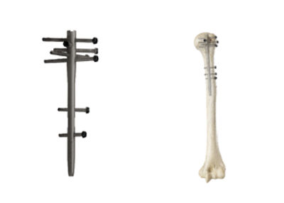 T2 Alpha Humerus
