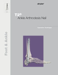 T2 Ankle Operative Technique