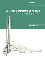 T2 Ankle Setup Guide
