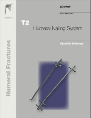 T2 Humeral Nailing System operative technique