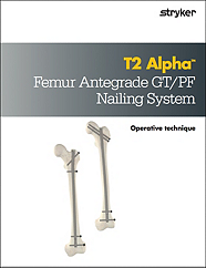 T2 Alpha Femur Antegrade GT/PF Operative Technique