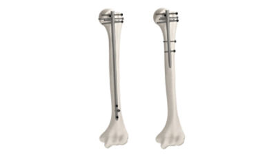 T2-Alpha-Humeral-image