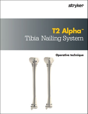 T2 Alpha Tibia Operative technique