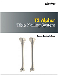 T2 Alpha Tibia Operative technique