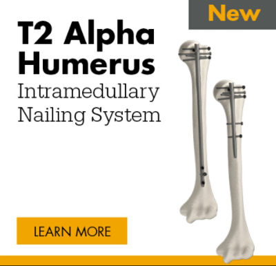 T2 Alpha Humerus