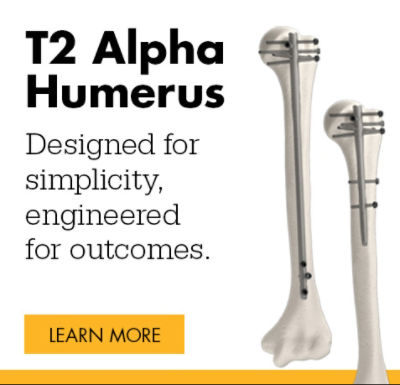 T2 Alpha Humerus