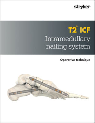T2 ICF Operative Technique