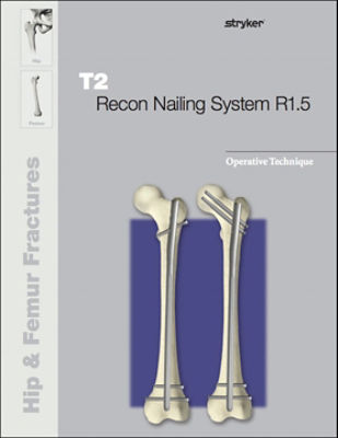 T2 Recon Nailing System R1.5 operative technique