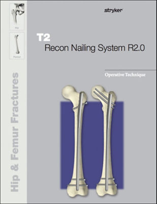 T2 Recon 2.0 operative technique
