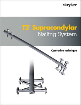 T2 Supracondylar operative technique