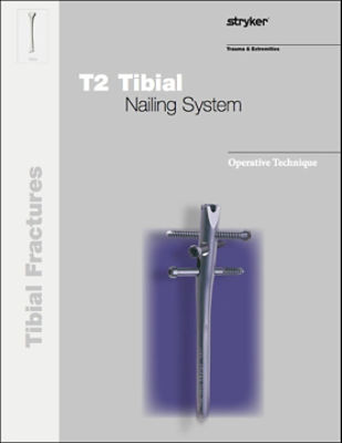 T2 Tibia operative technique