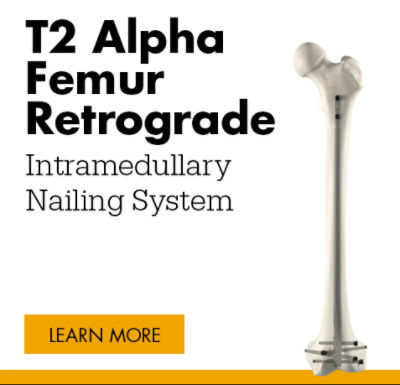 T2 Alpha Femur Retrograde